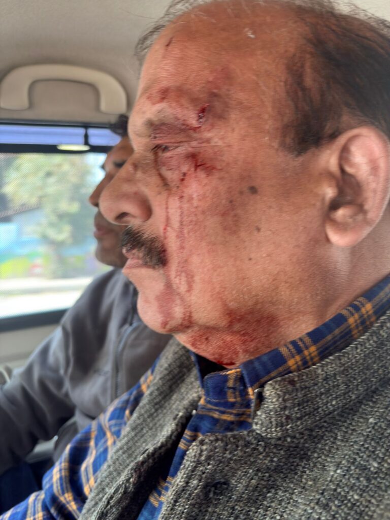 dehradun-director-ajay-nautiyal-assault-bjp-mla-umesh-kau-row